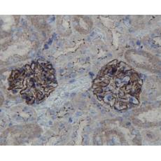 Anti-ZO1 antibody