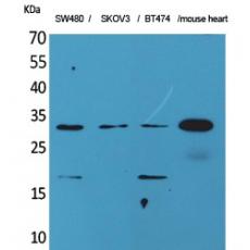 Anti-FGF-18 antibody