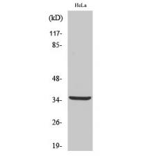 Anti-Cleaved-Cathepsin L2 (L114) antibody