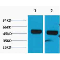 Anti-beta 1 Sodium Potassium ATPase antibody