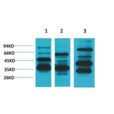 Anti-Mas1 antibody