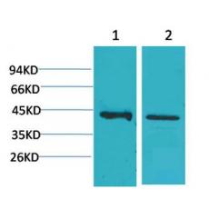 Anti-CALHM1 antibody