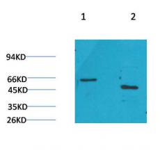 Anti-GLP1R antibody