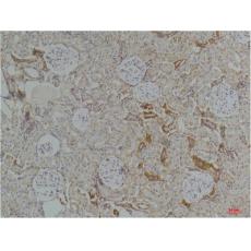 Anti-Kir4.1 antibody