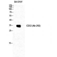 Anti-CD32 antibody