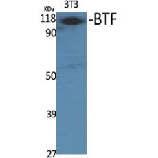 Anti-BTF antibody
