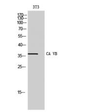 Anti-CA VB antibody