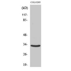 Anti-CB2 antibody