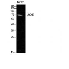 Anti-AChE antibody