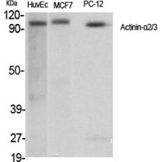 Anti-Actinin-α2/3 antibody