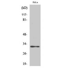 Anti-AIG-1 antibody