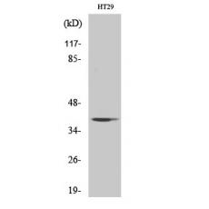 Anti-AHA-1 antibody