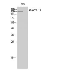 Anti-ADAMTS-19 antibody