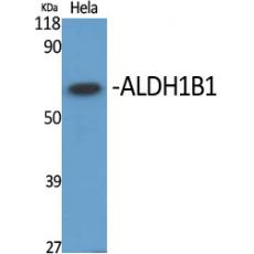 Anti-ALDH1B1 antibody