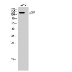 Anti-ADNP antibody