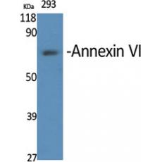 Anti-Annexin VI antibody