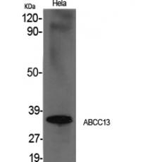 Anti-ABCC13 antibody