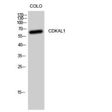 Anti-CDKAL1 antibody