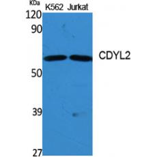 Anti-CDYL2 antibody