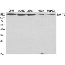 Anti-BAF170 antibody