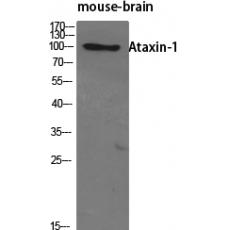 Anti-Ataxin-1 antibody