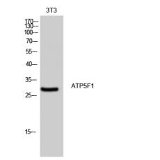 Anti-ATP5F1 antibody