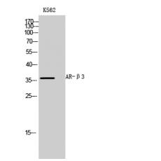 Anti-AR-β3 antibody