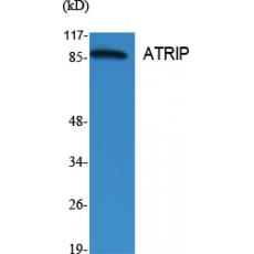 Anti-ATRIP antibody