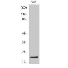 Anti-Cerebellin 2 antibody