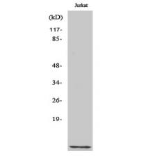 Anti-Cks1 antibody