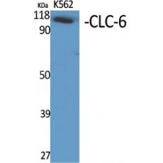 Anti-CLC-6 antibody