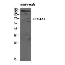 Anti-COL4A1 antibody