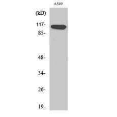 Anti-Liprin β1 antibody