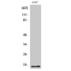 Anti-LMO3 antibody