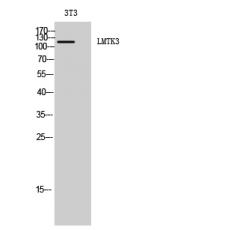 Anti-LMTK3 antibody
