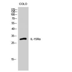 Anti-IL-15Rα antibody