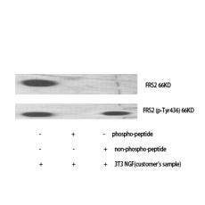 Anti-FRS2 antibody