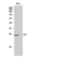 Anti-CHP antibody