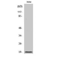 Anti-Cofilin antibody