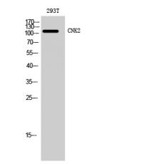 Anti-CNK2 antibody