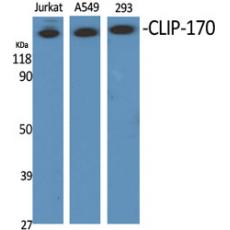 Anti-CLIP-170 antibody