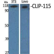 Anti-CLIP-115 antibody