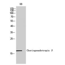 Anti-Choriogonadotropin β antibody