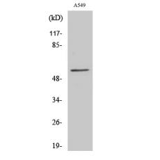 Anti-CHST2 antibody