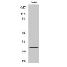 Anti-LDLRAD2 antibody