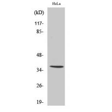 Anti-IgA antibody