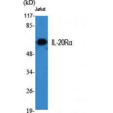 Anti-IL-20Rα antibody