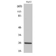 Anti-IL-32 antibody