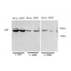 Anti-LBP antibody