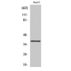 Anti-L-type Ca++ CP γ7 antibody